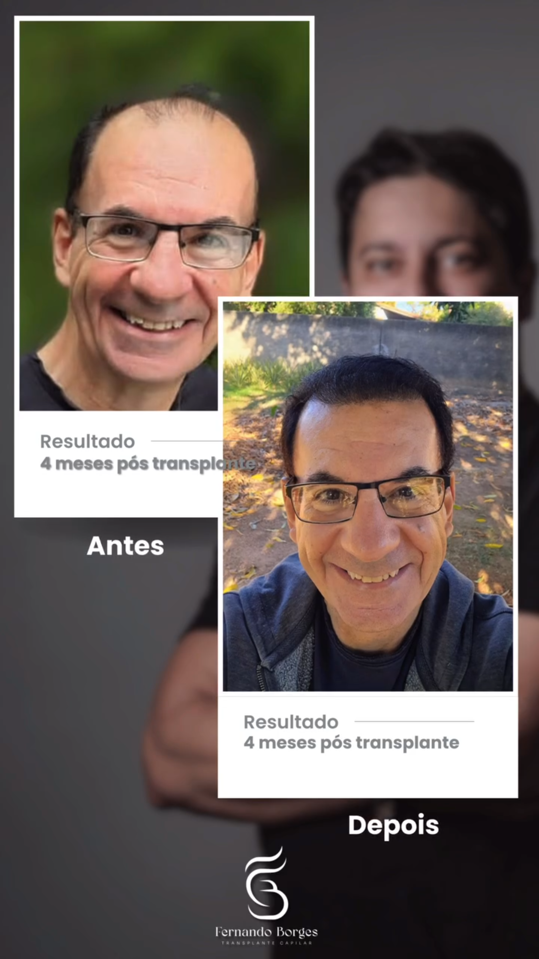 uploads/frames pro hair(1).png